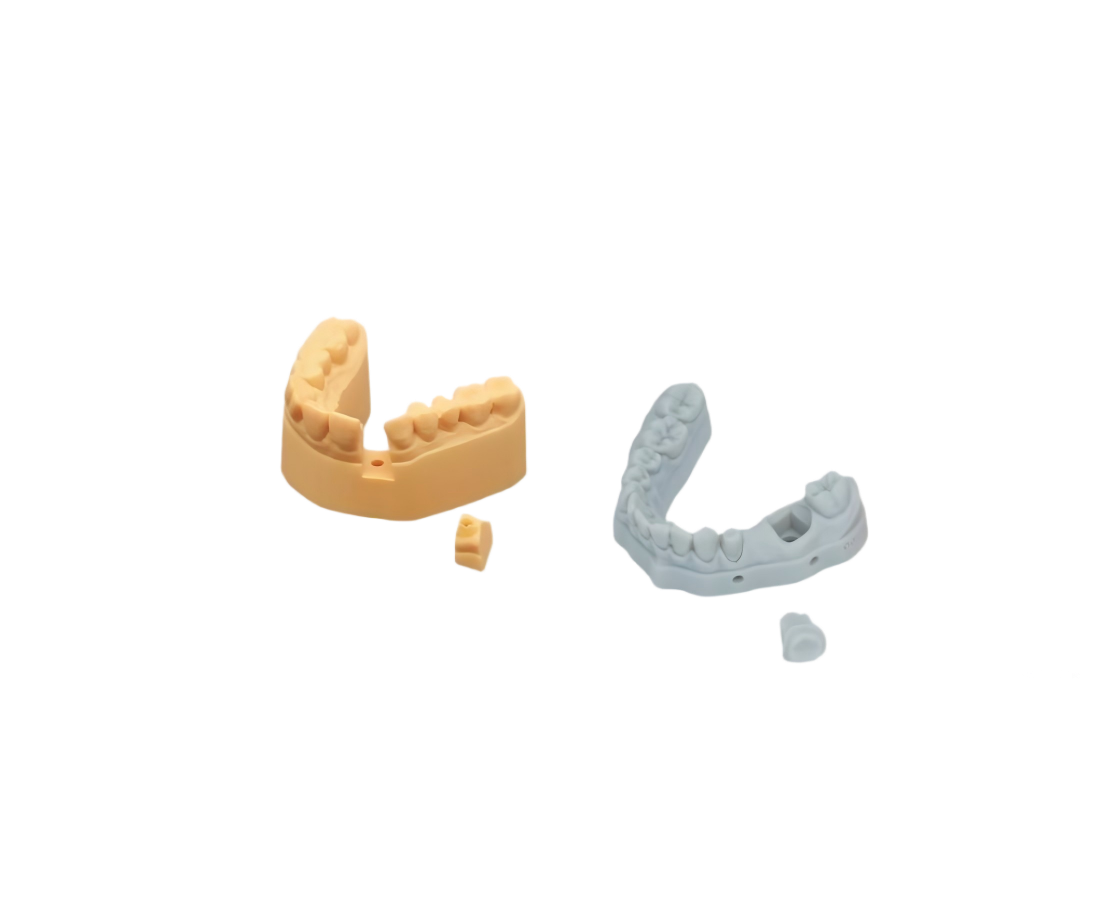 Implant Model