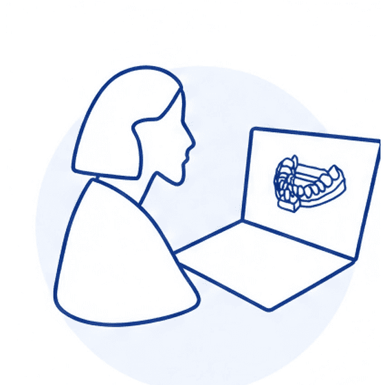 Design step illustration